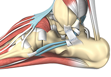 Ankle Ligament Reconstruction