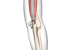 Triceps Injuries